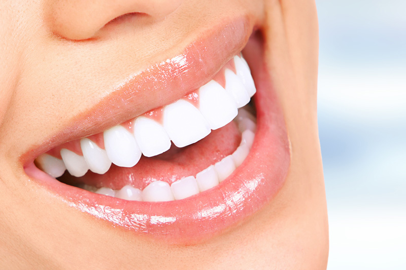 Cosmetic Dentistry in Tampa